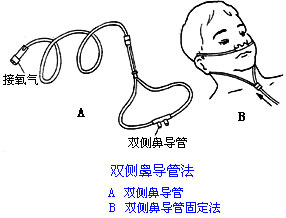 ◆肺病患者如何家庭氧療？